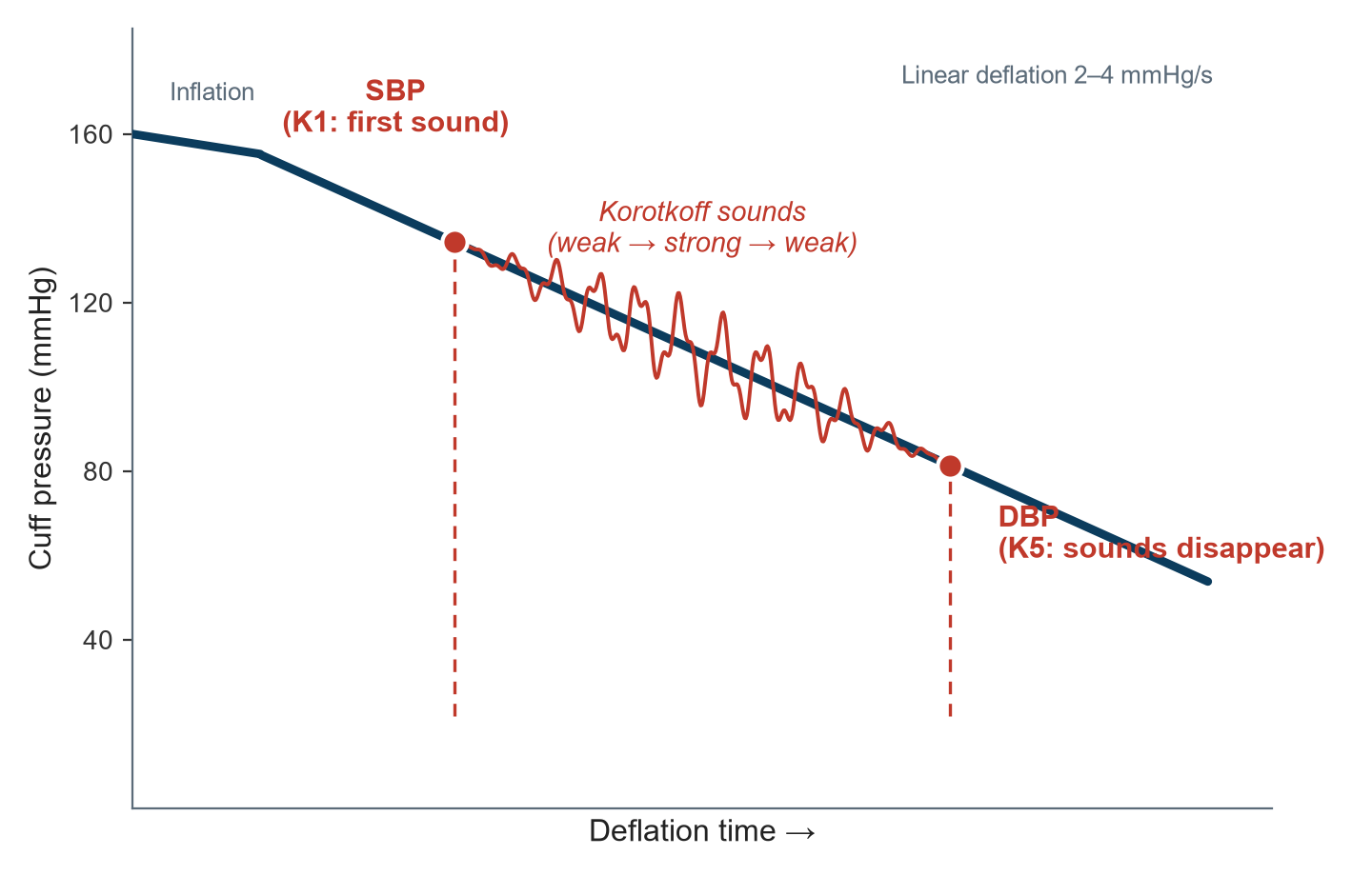 Cuff pressure declining during linear deflation, with Korotkoff sounds riding the pressure trace between SBP at K1 and DBP at K5
